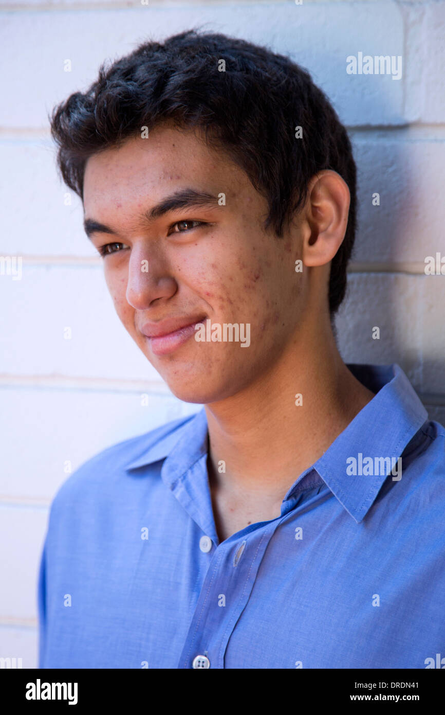 Male adolescent with acne on his face Stock Photo