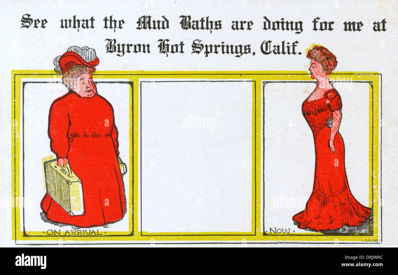 Benefits of a Mud Bath Slimming Success!! Stock Photo Alamy