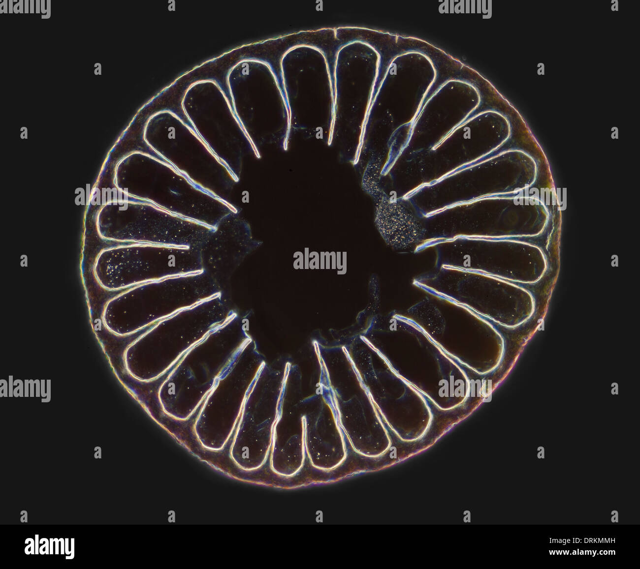 Hedgehog spine, TS, darkfield photomicrograph Stock Photo