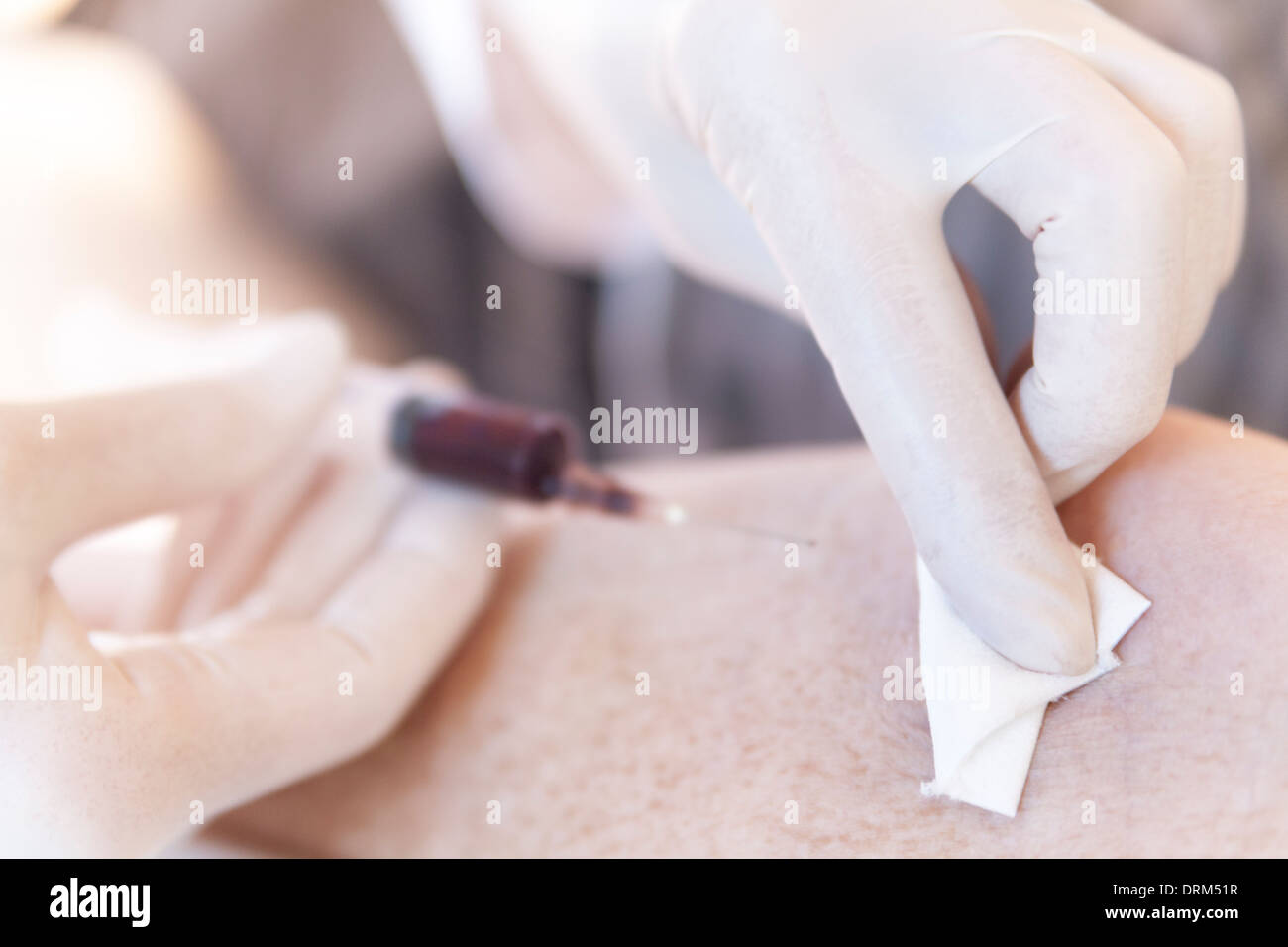 Female alternative practitioner dabing off blood after a blood sample Stock Photo