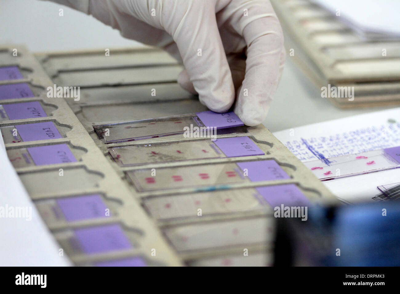 histology real samples object slides for light microscope Stock Photo