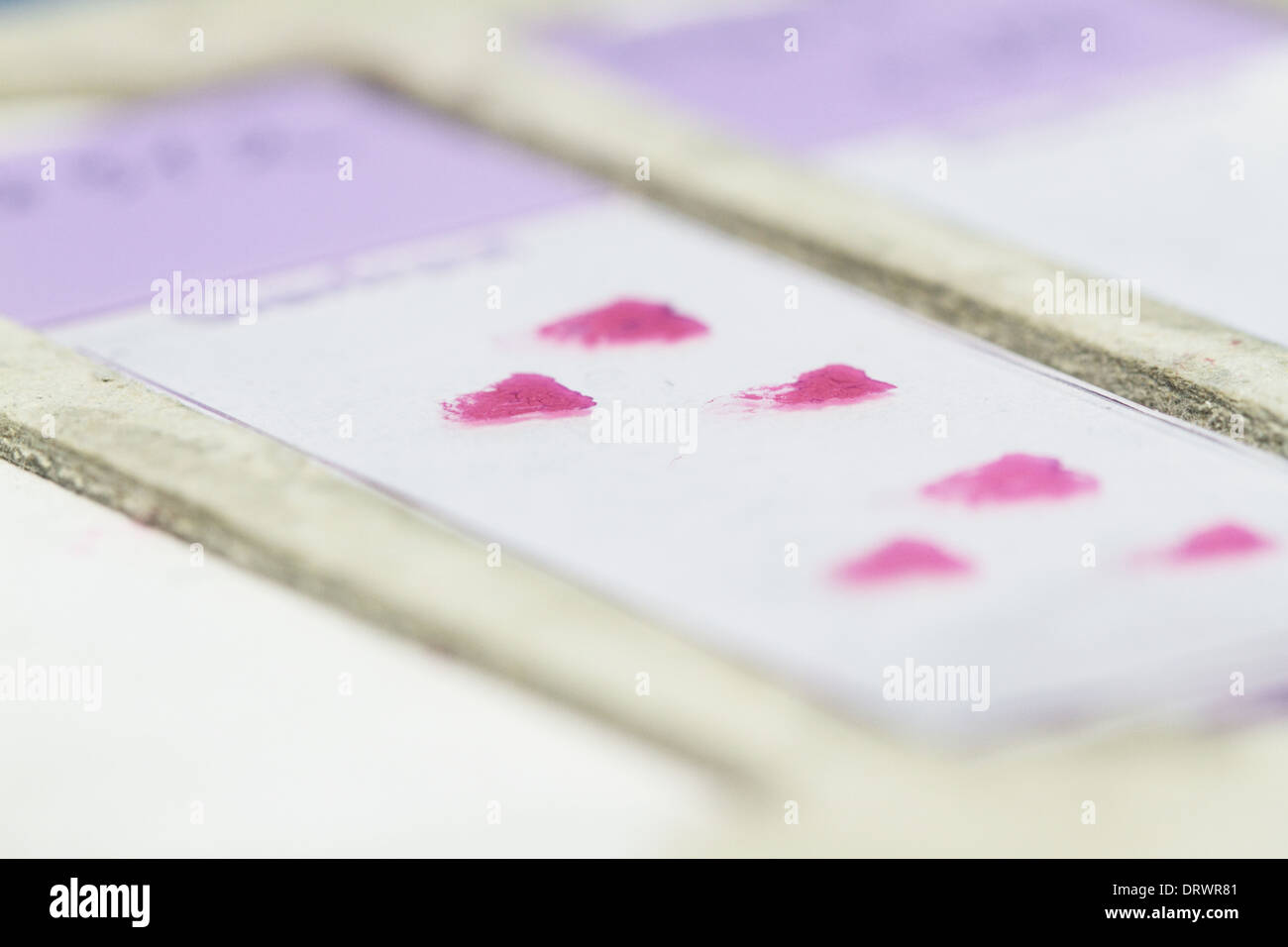 histology real samples object slides for light microscope Stock Photo