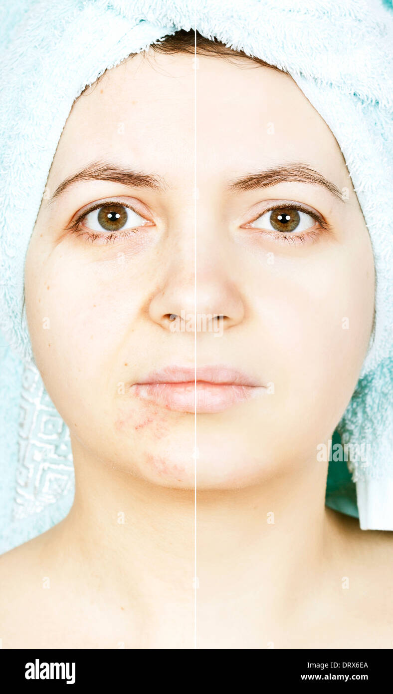 Before and after half faces of a woman Stock Photo Alamy