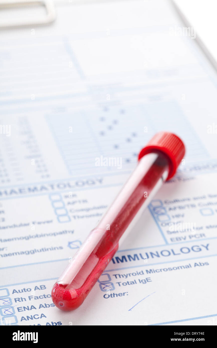 Blood vial hires stock photography and images Alamy