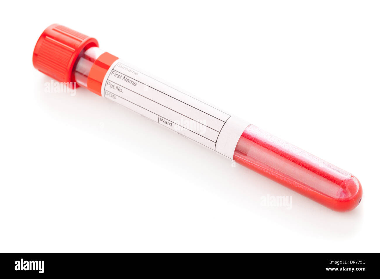 Blood testing test sample vial Cut Out Stock Images & Pictures Alamy