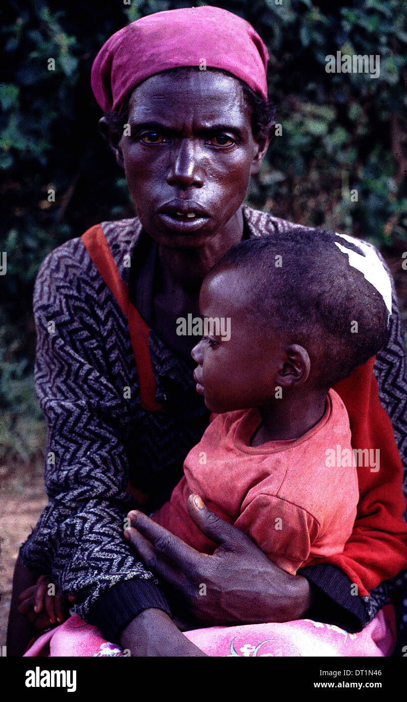 Tutsis In Rwanda Rwanda genocide 1994 wounded hi-res stock photography and images - Alamy