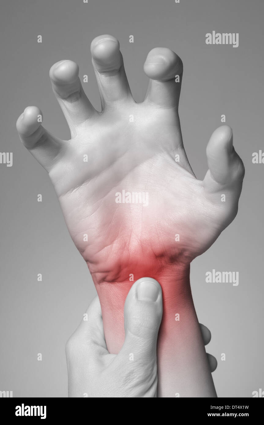 Wrist pain rheumatoid arthritis hires stock photography and images Alamy