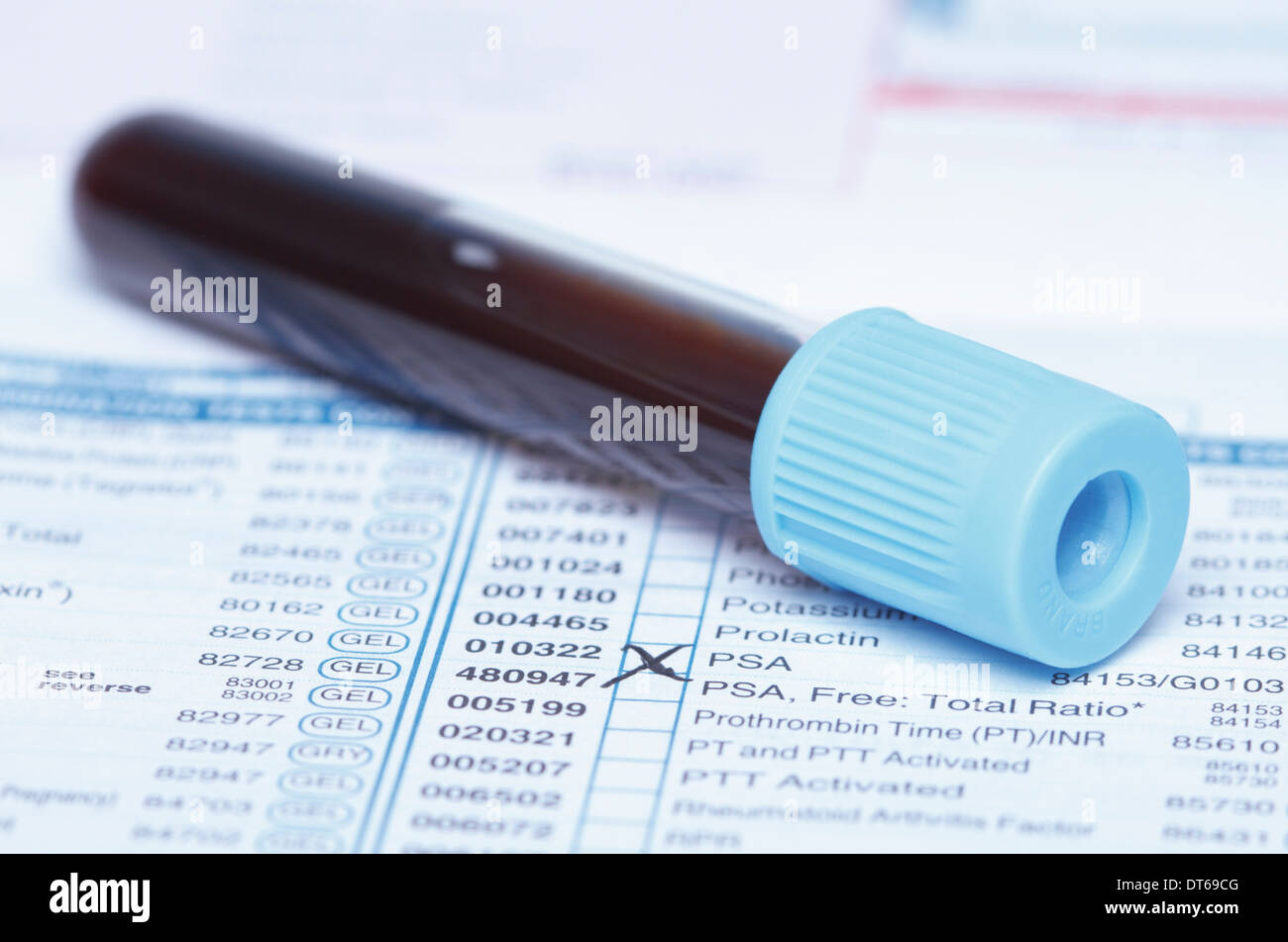 Color coded tube containing synthetic blood sample on a bloodwork requisition form that lists a test for prostate-specific Stock Photo