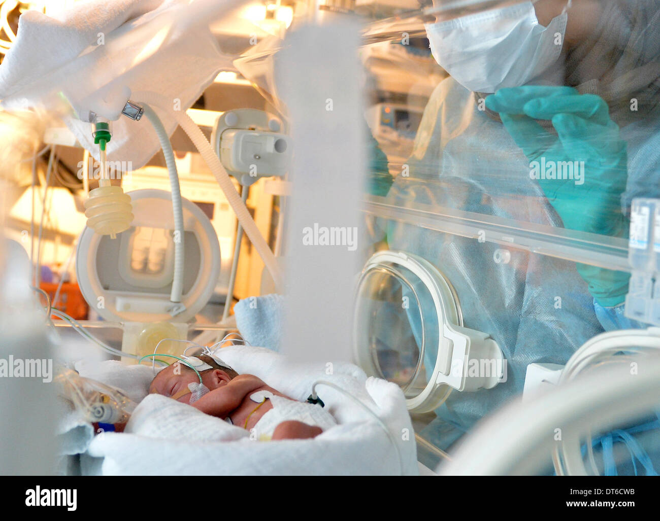 A premature newborn infant lies in an incubator at the neonatal Stock