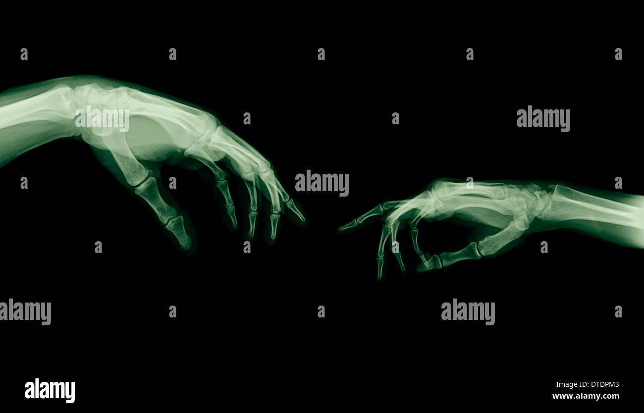 The Creation of Adam (Michelangelo) two hands under x-ray Stock Photo