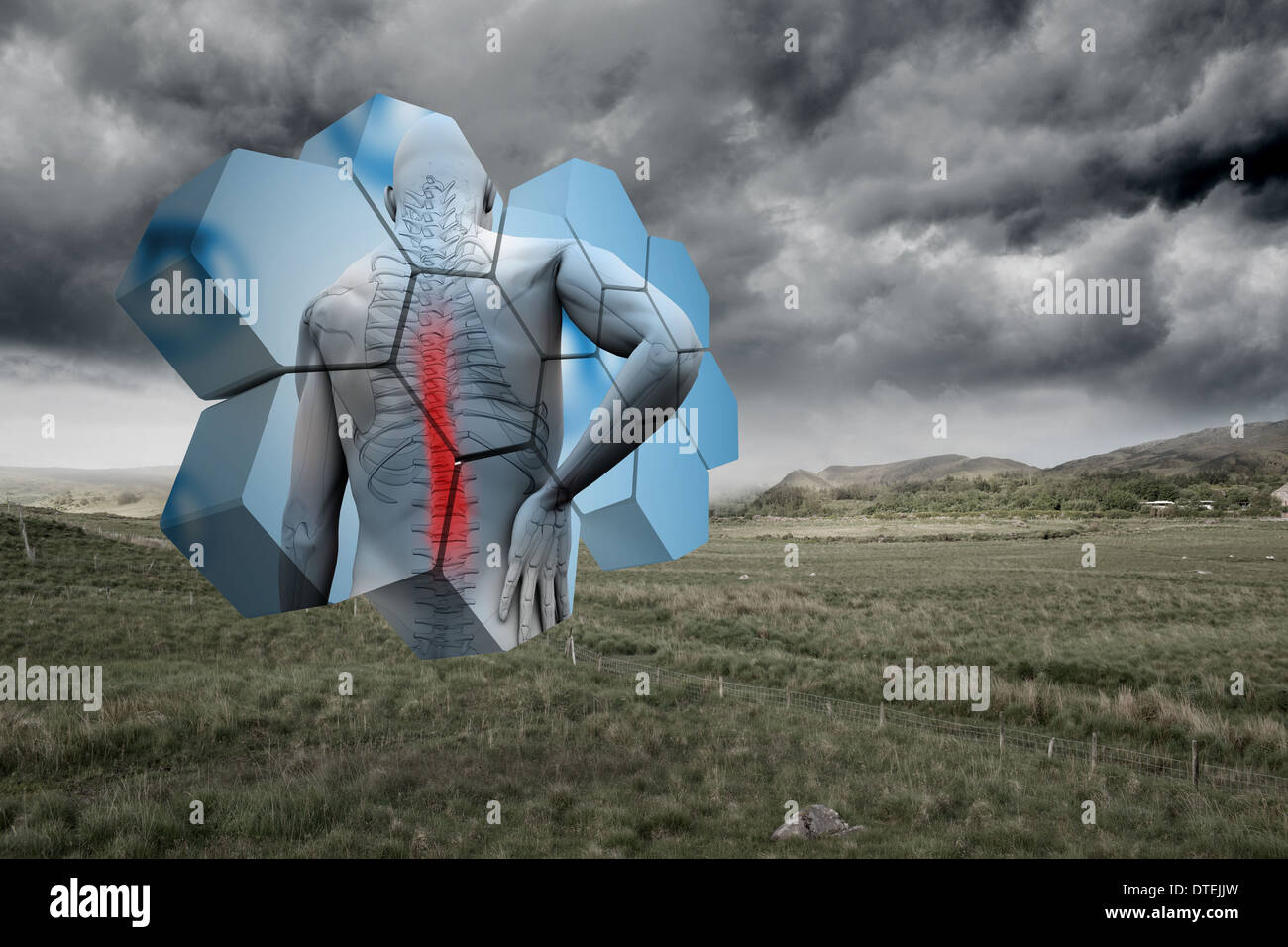 Composite image of back injury diagram on abstract screen Stock Photo ...