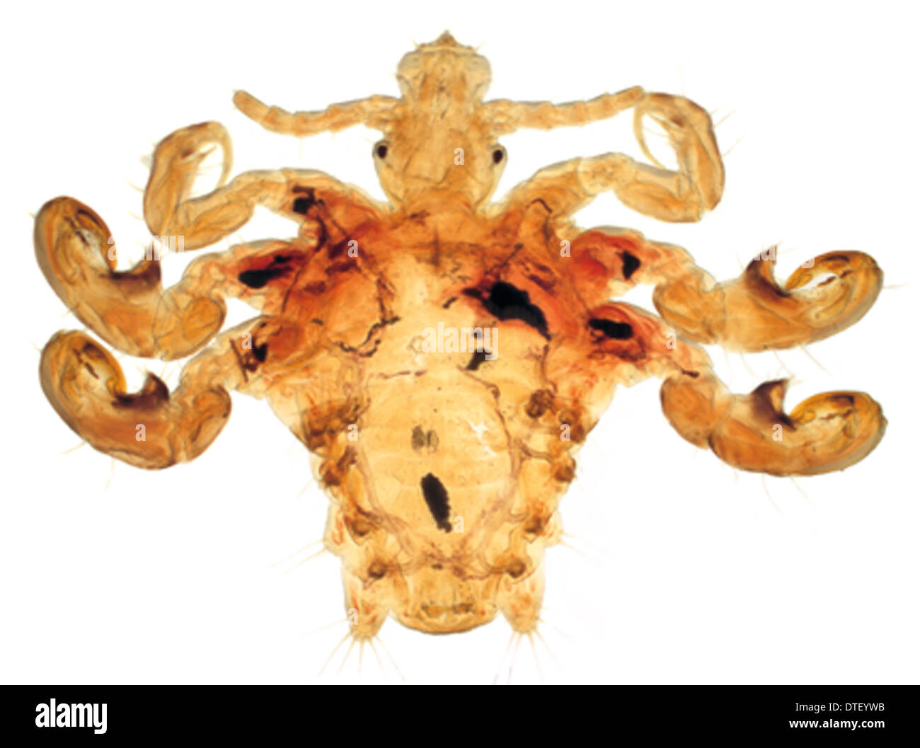 Pthirus pubis, crab louse Stock Photo