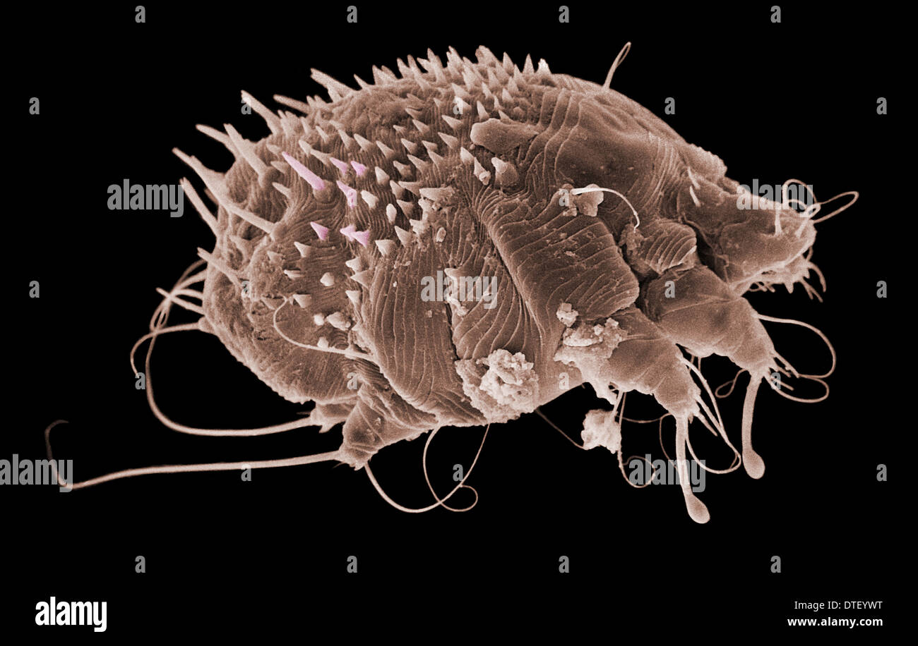 Sarcoptes scabiei, scabies mite Stock Photo