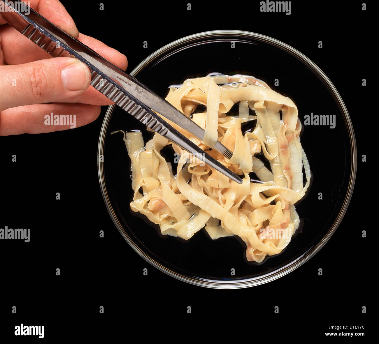 Taenia saginata, beef tapeworm Stock Photo 66712112 Alamy