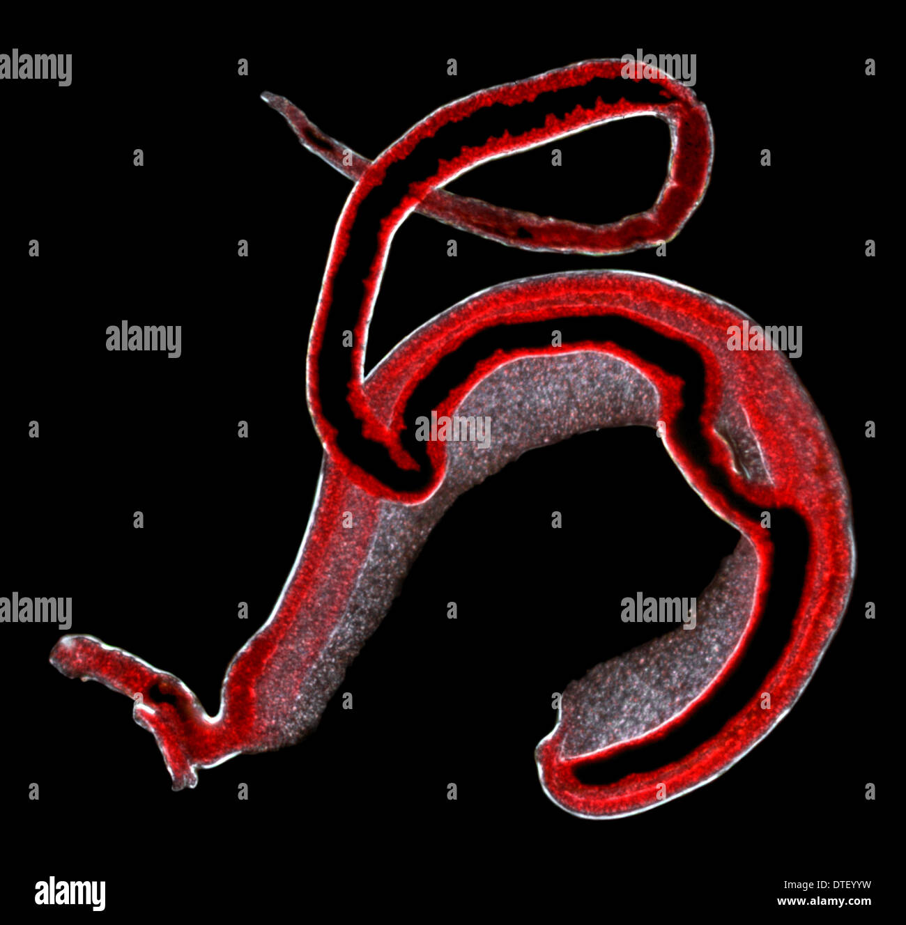 Schistosoma spp., blood flukes Stock Photo