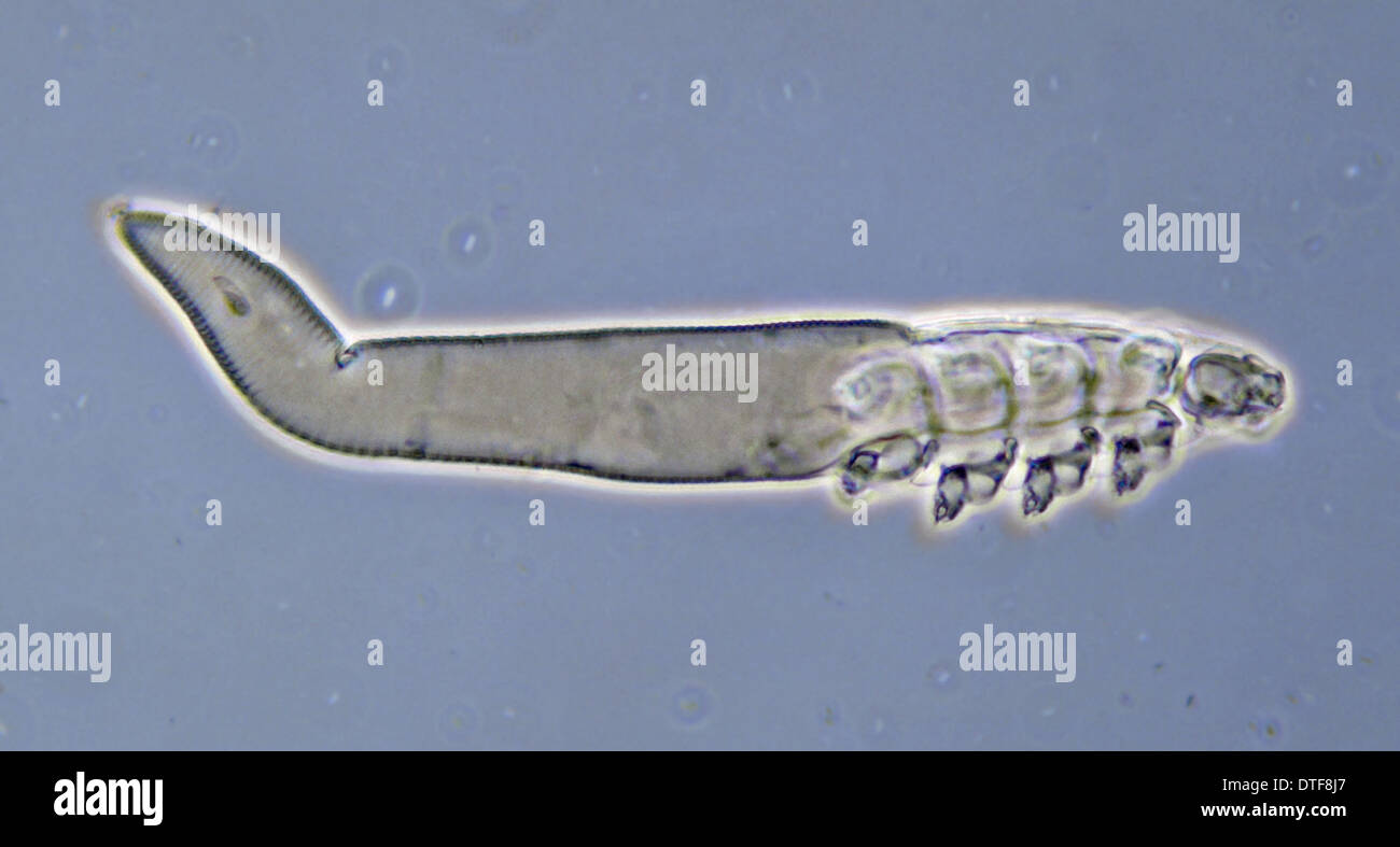 Demodex hi-res stock photography and images - Alamy