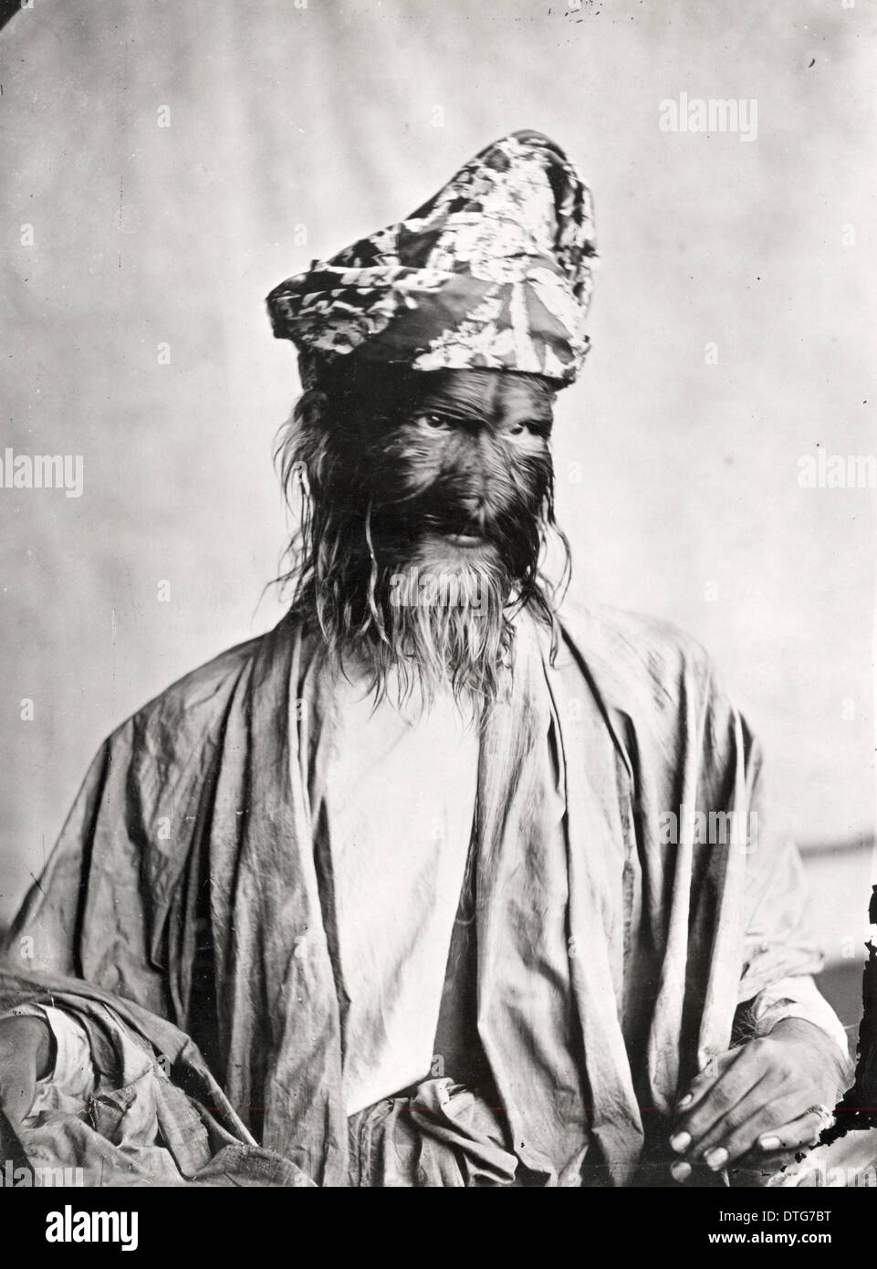 The hairy family of burma