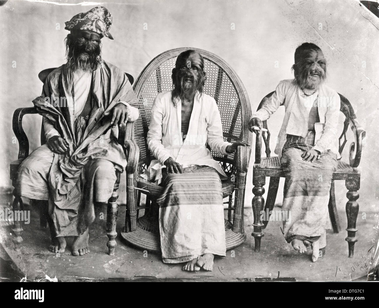 The Hairy Family Of Burma Stock Photo Alamy