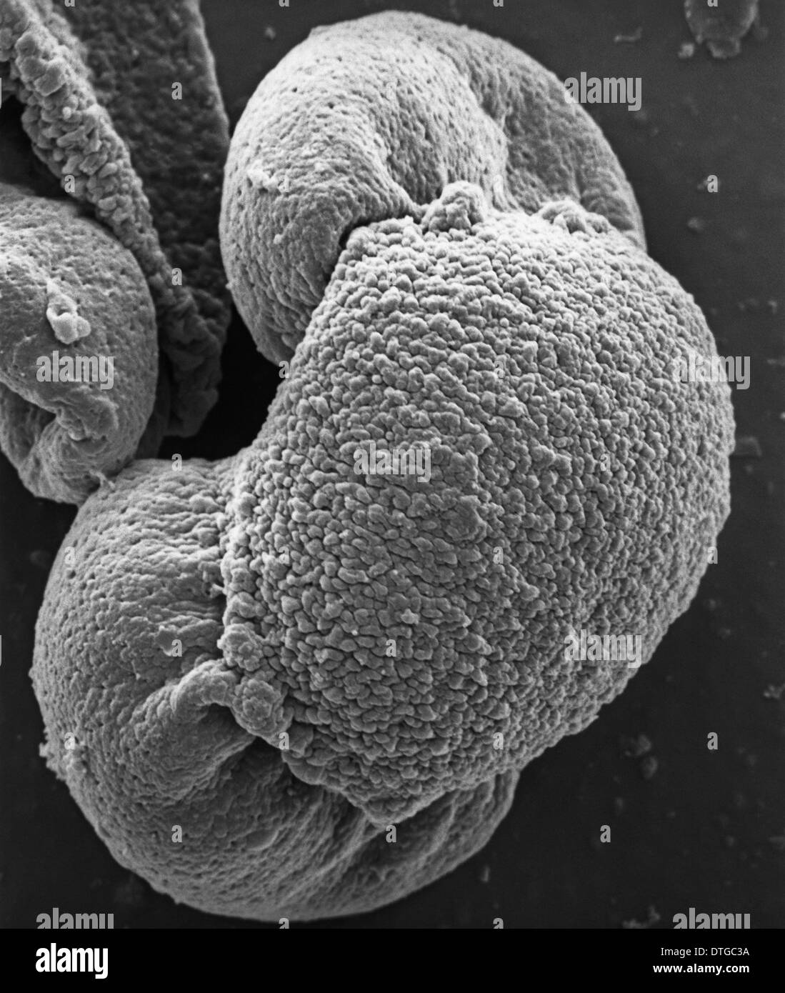 Черная пыльца. Пыльца Pinus Sylvestris. Пыльца сосны микроскоп. Зерно сосны под микроскопом. Пыльца клена под микроскопом.