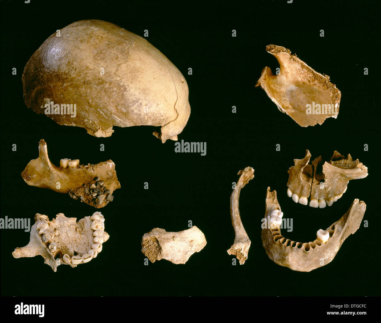 Modern Homo sapiens. A range of human remains (cranial and postcranial) Stock Photo
