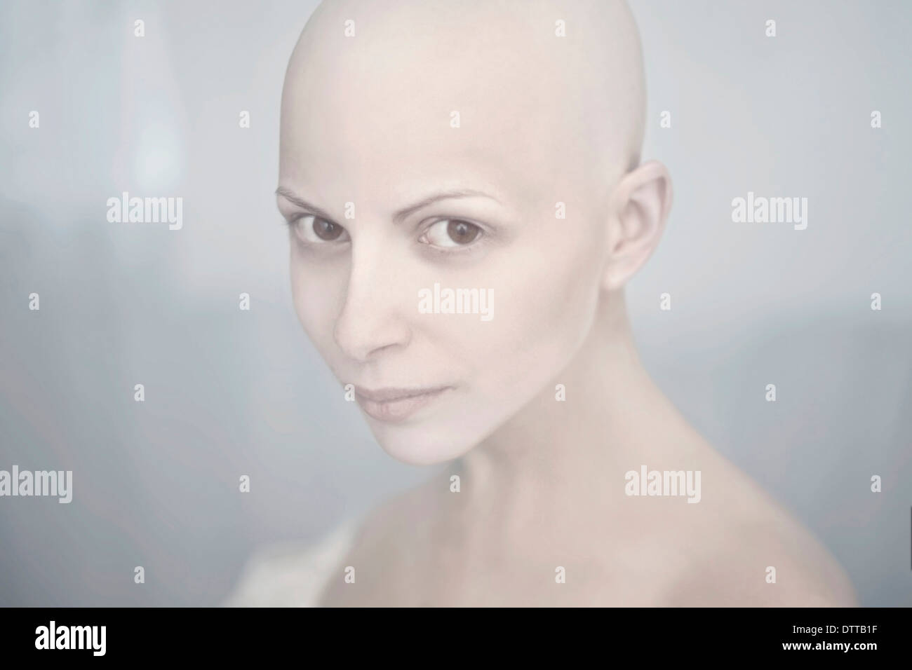 Woman With Bald Head Hi Res Stock Photography And Images Alamy