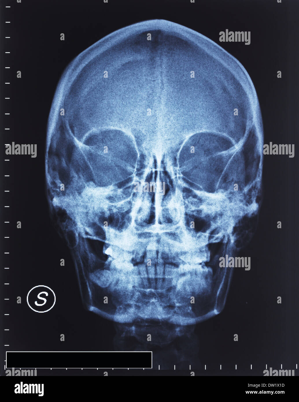 Xray hires stock photography and images Alamy