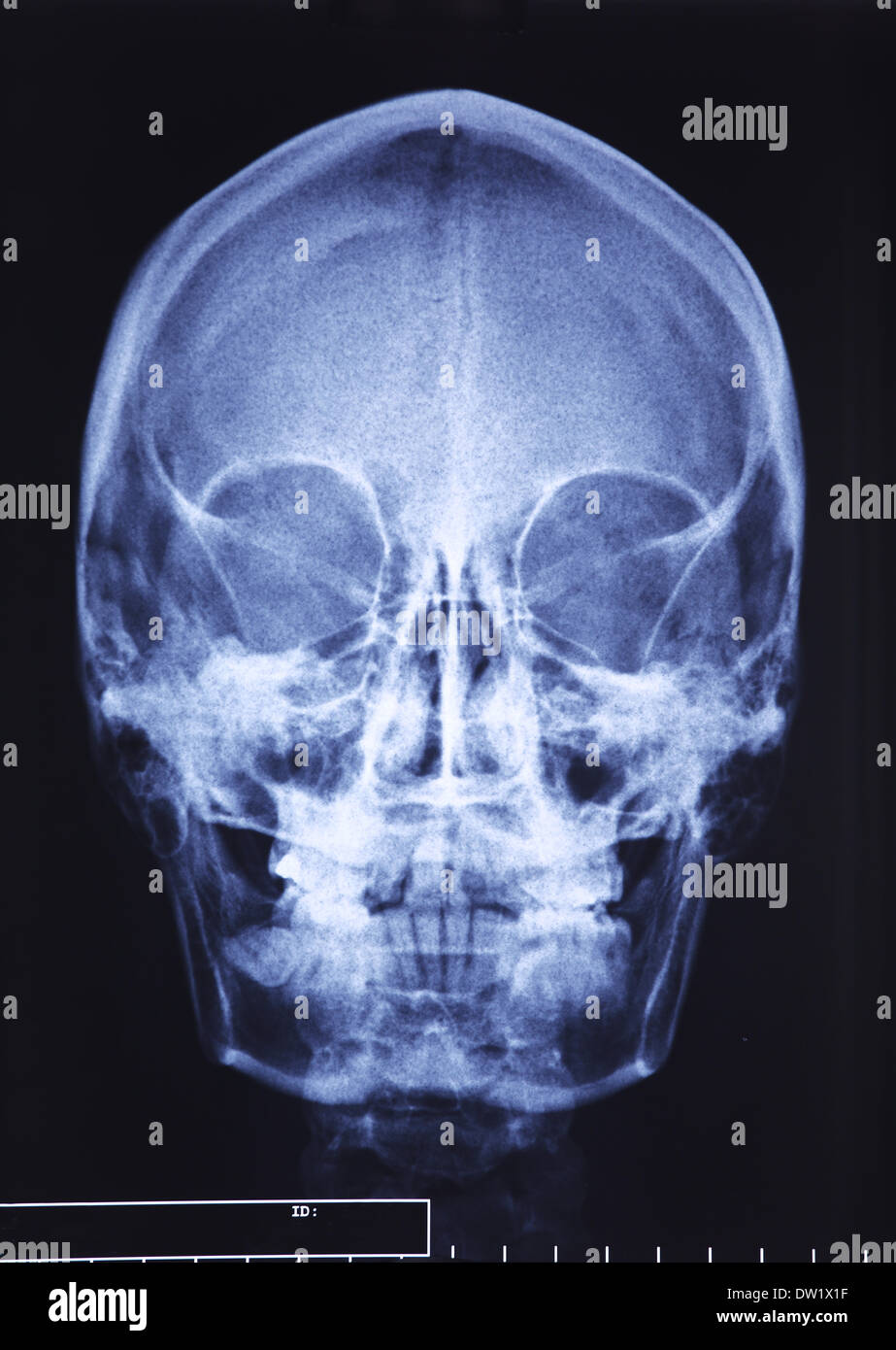 Xray hi-res stock photography and images - Alamy
