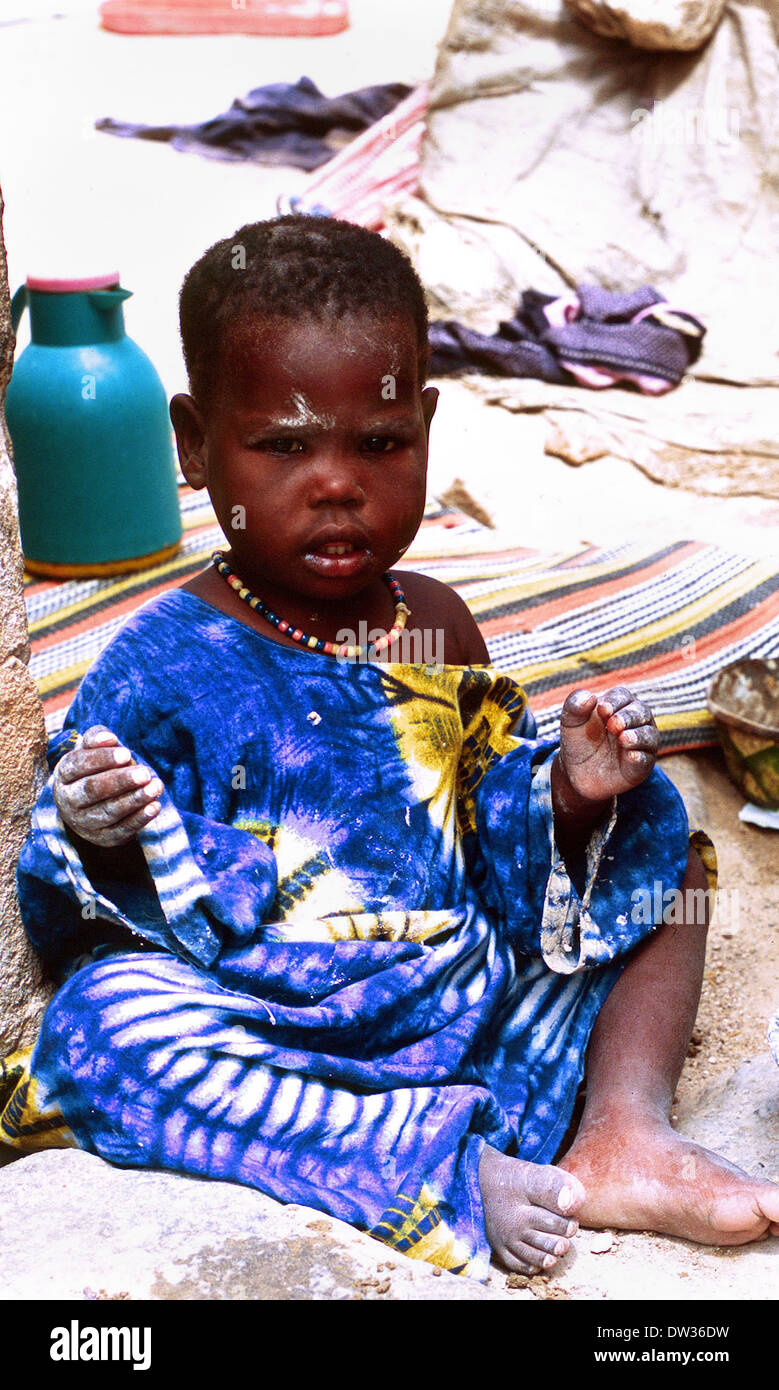 Displaced Somali Bantu child in Galkayo in Somalia Stock Photo