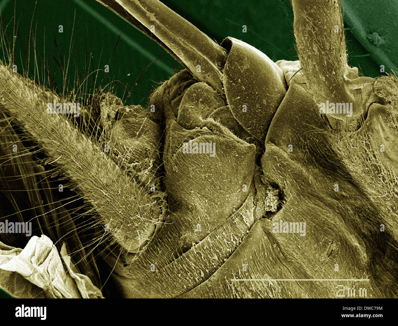 Coloured SEM of house cricket (Acheta domesticus) leg spurs Stock Photo