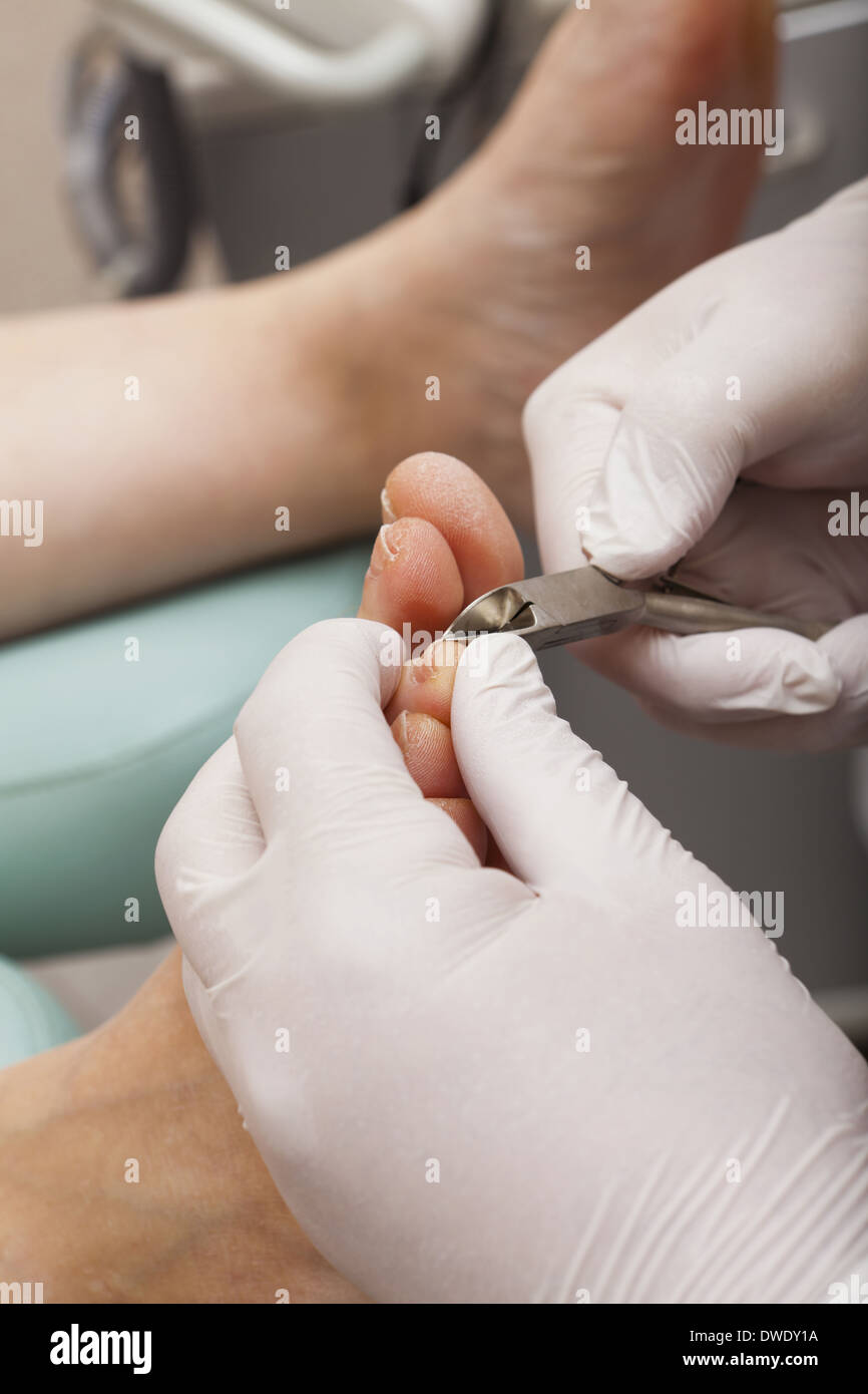 A chiropodist taking care of woman's foot cutting nails with a