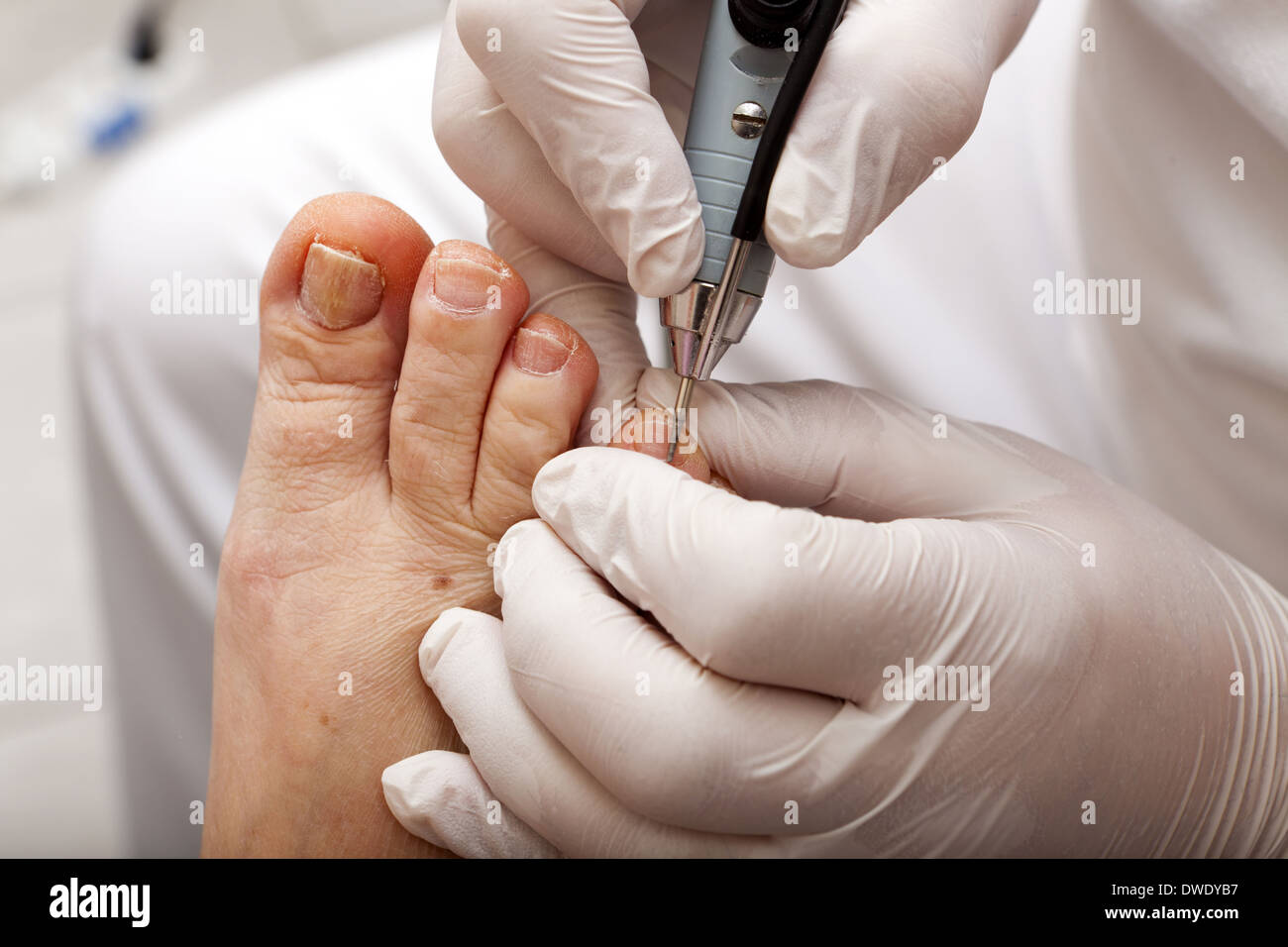 Medical foot care with grinding machine Stock Photo Alamy
