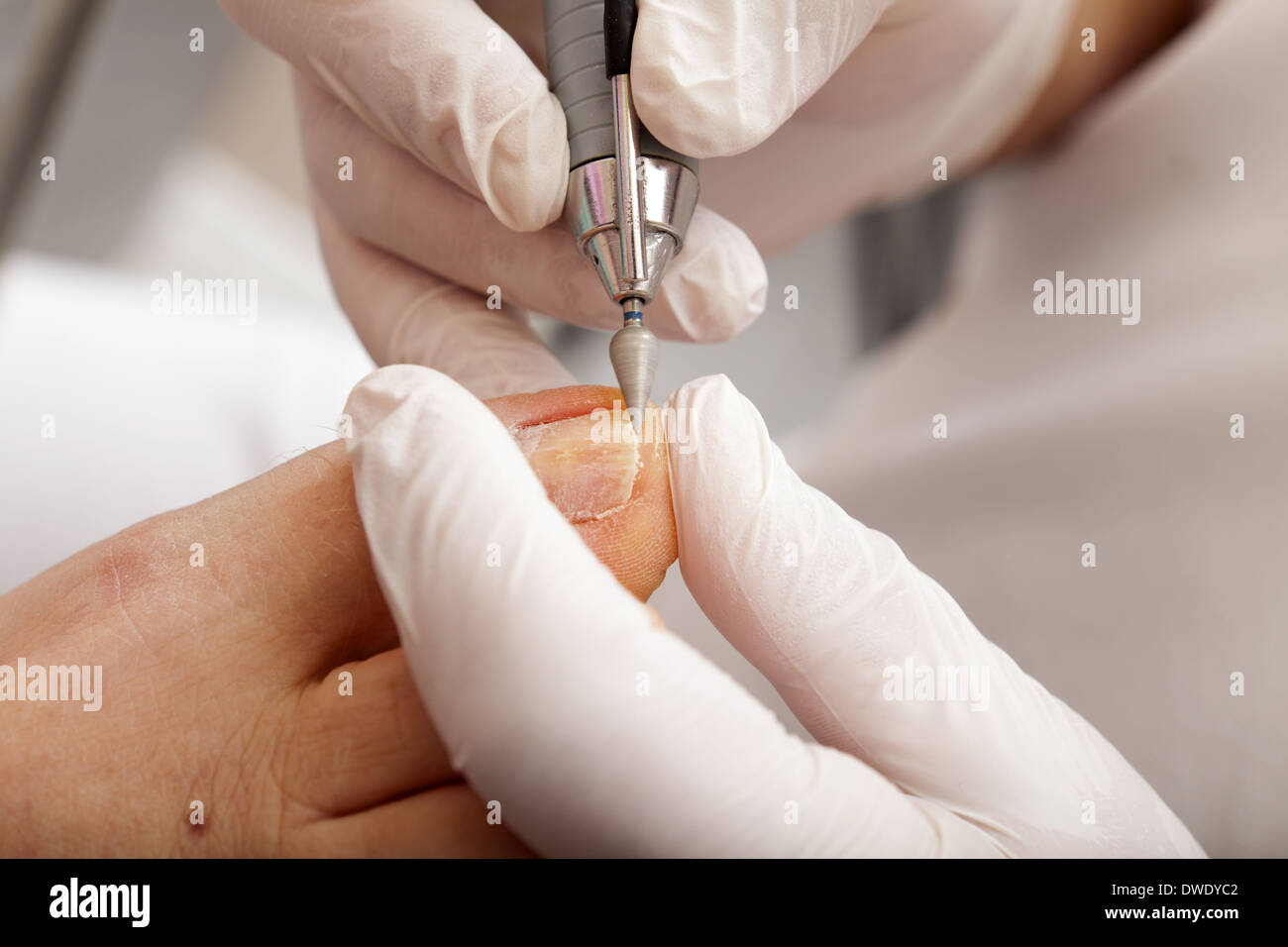 Chiropodist polishing the nails with a special tool Stock Photo