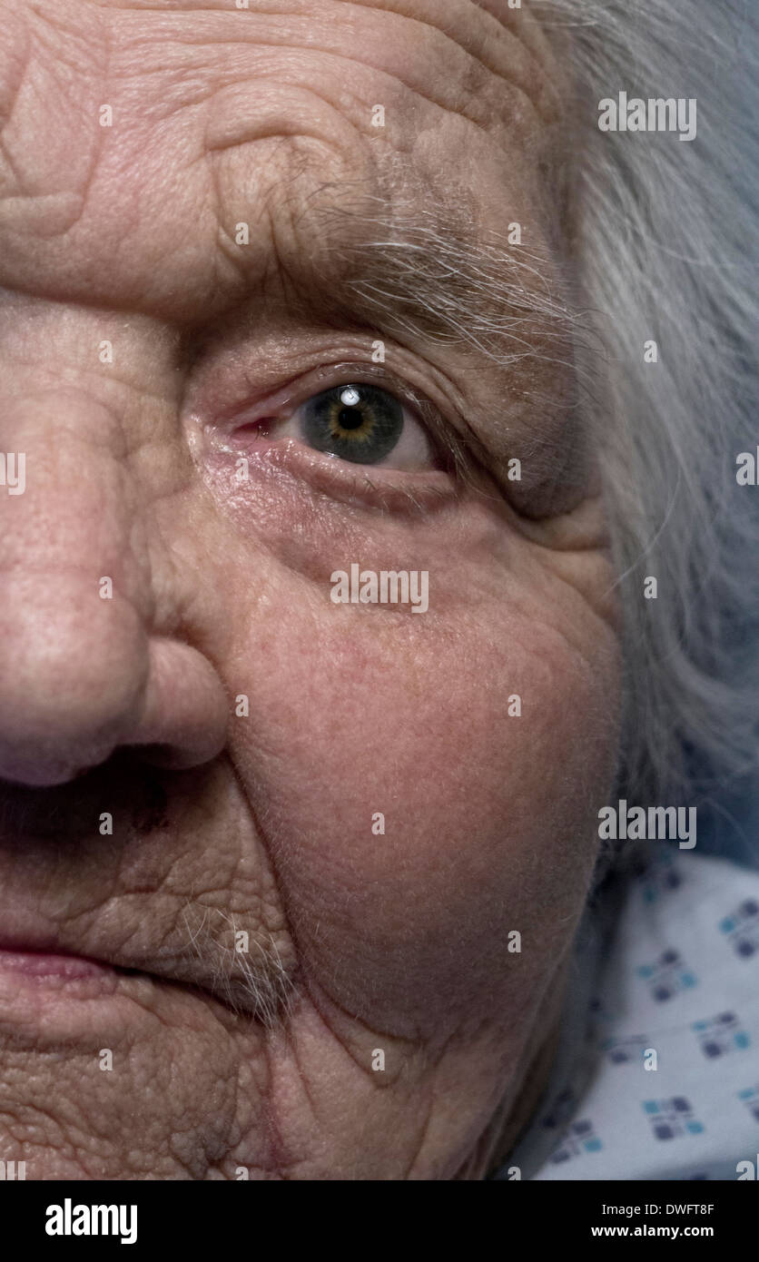 elderly old vulnerable 100 years old lady face close up alone in hospital care bed Stock Photo