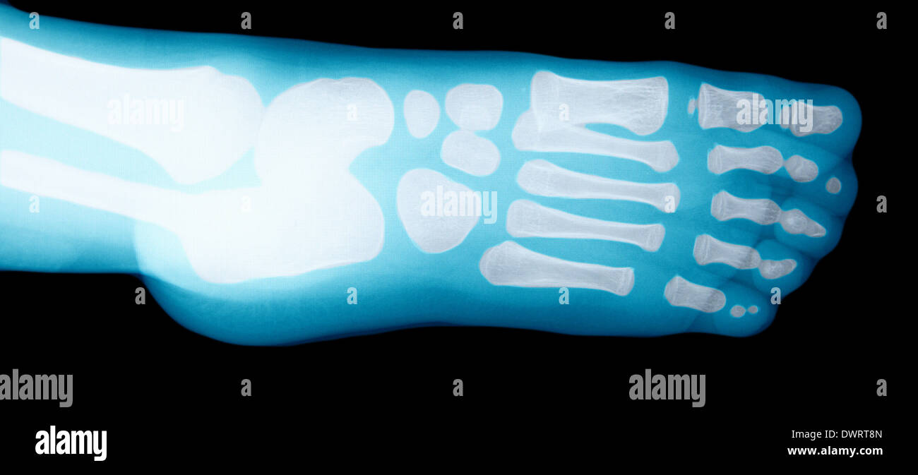 Foot x ray Stock Photo Alamy