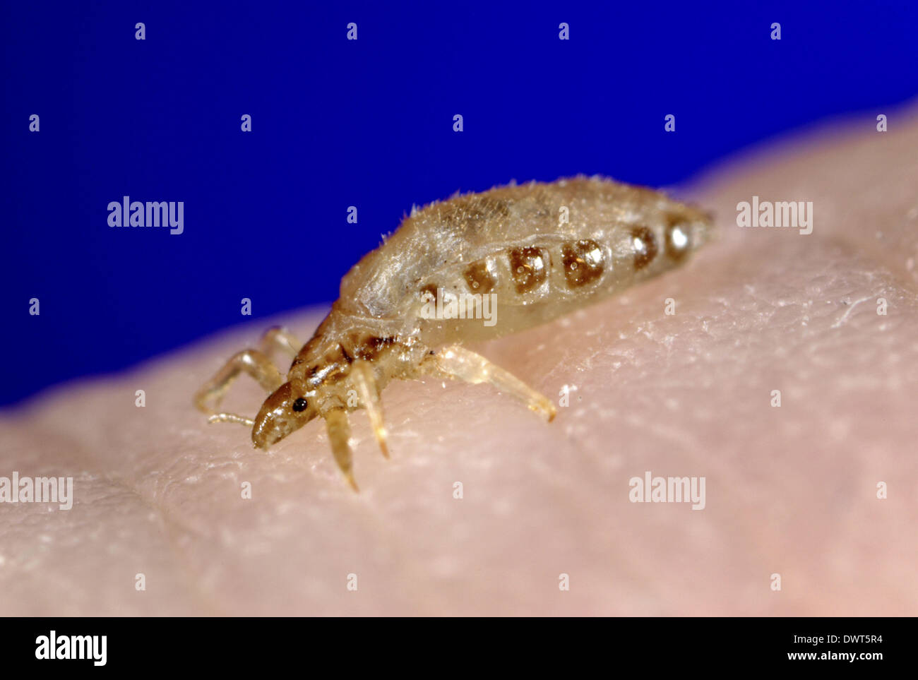 Body louse Stock Photo Alamy