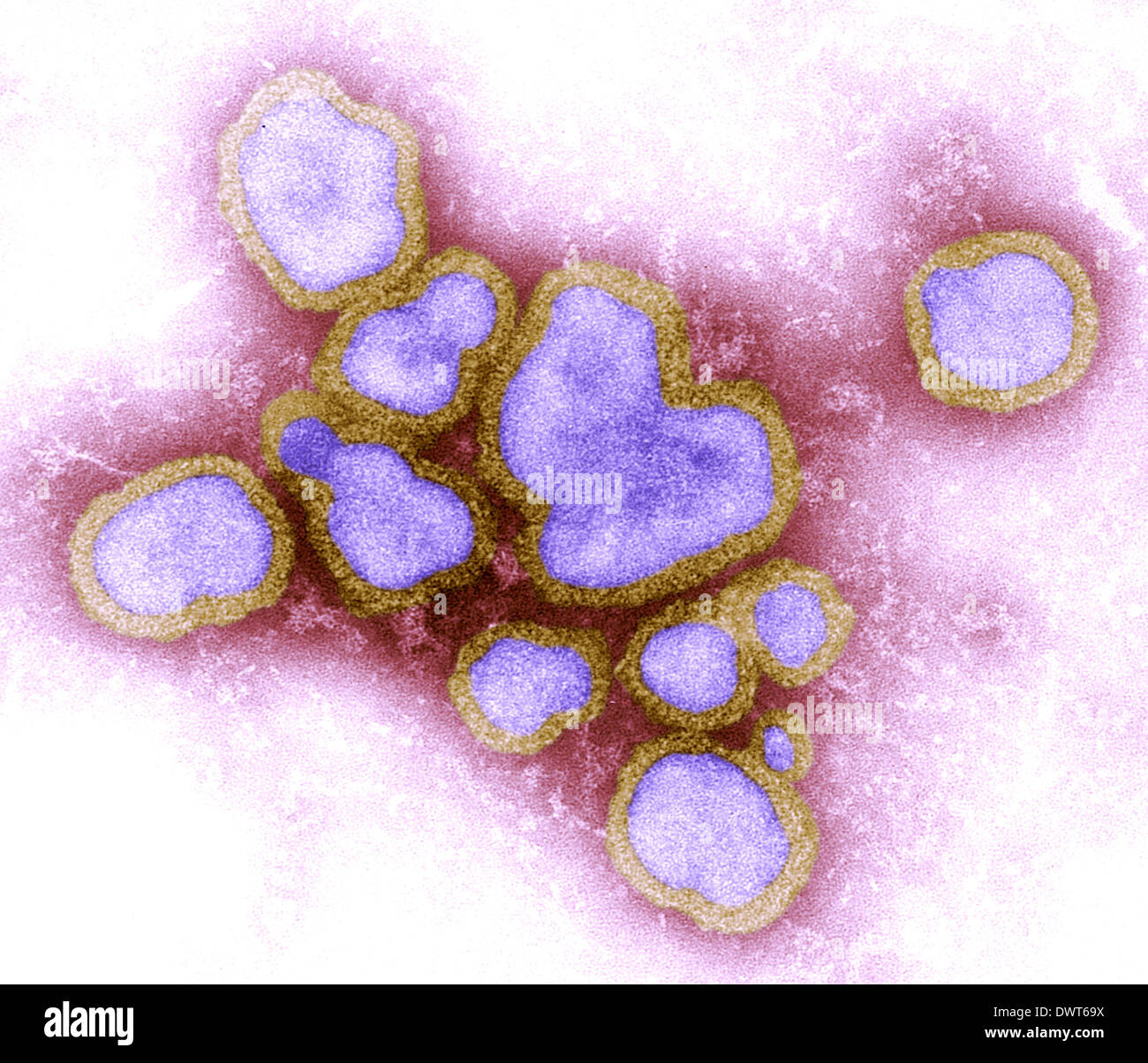Influenza virus microscope hi-res stock photography and images - Alamy