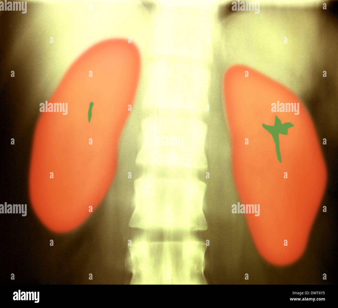 Urinary system x ray Stock Photo Alamy