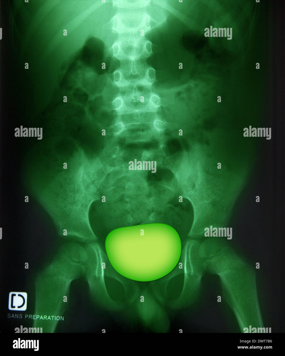 Retrograde hires stock photography and images Alamy