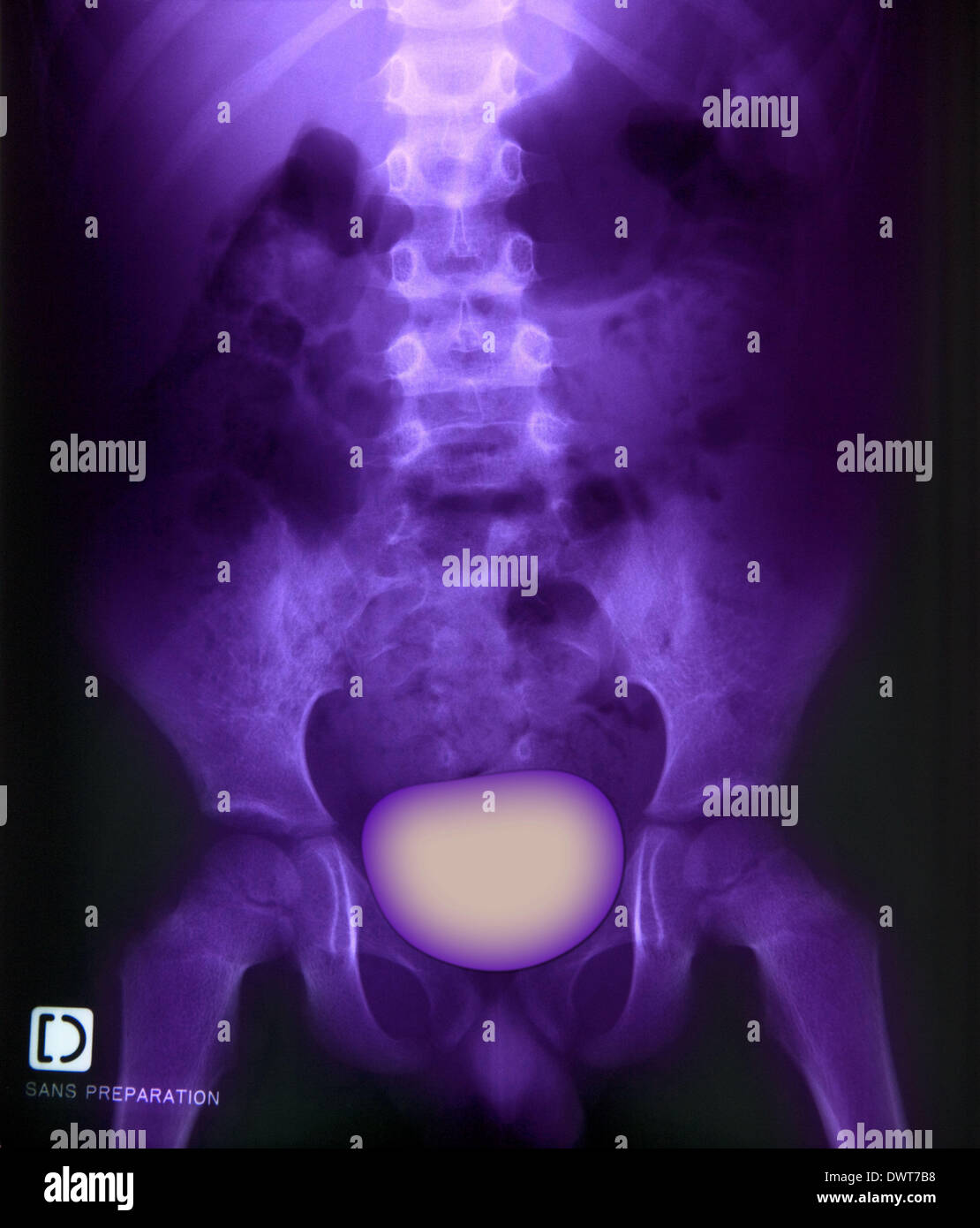 Retrograde hires stock photography and images Alamy