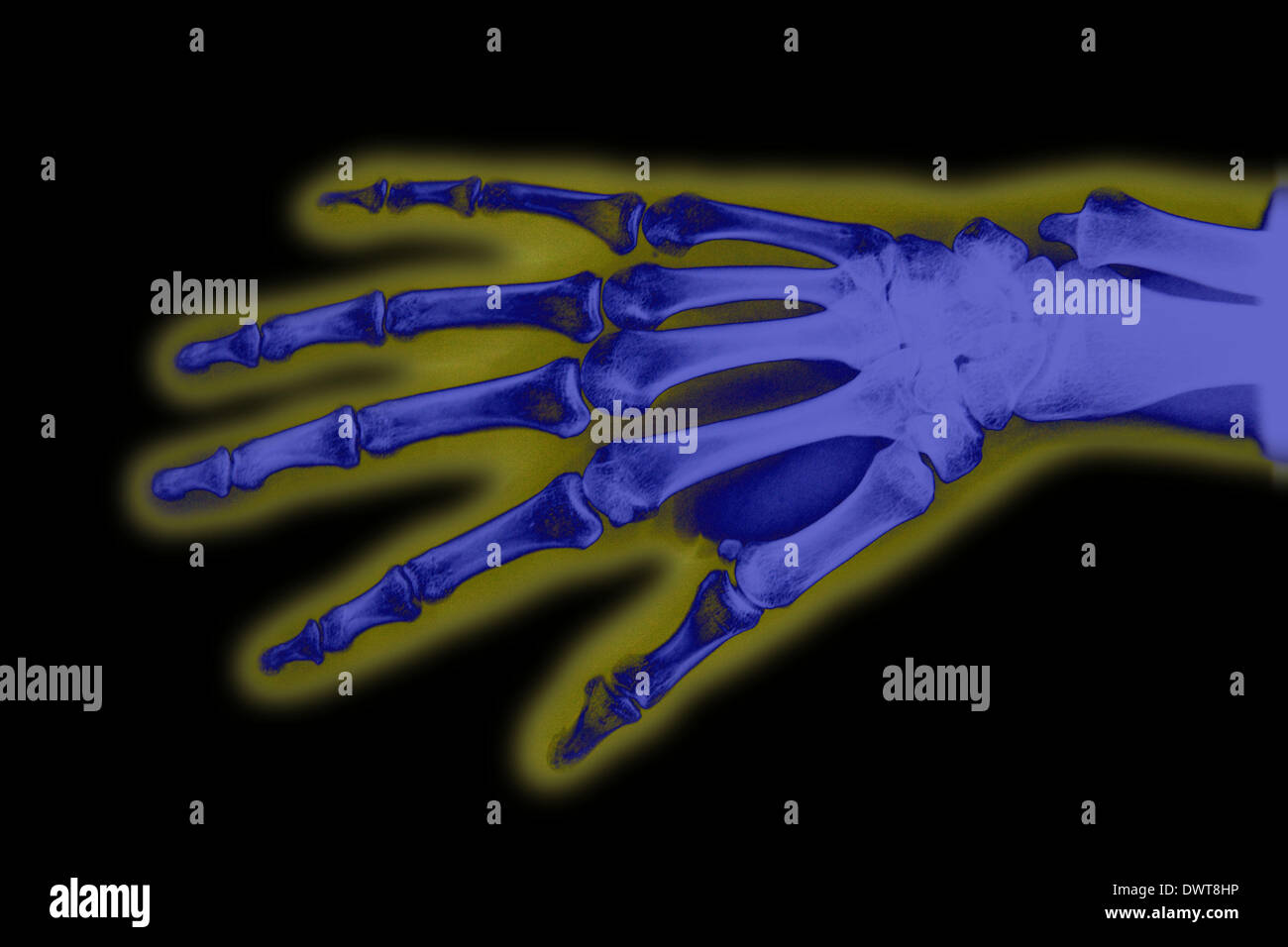 Hand x ray Stock Photo Alamy