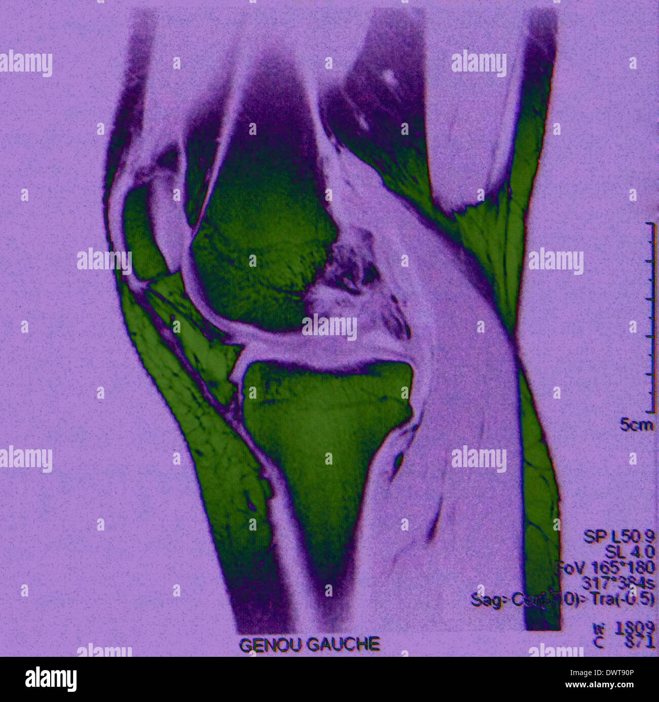 Knee mri Stock Photo Alamy