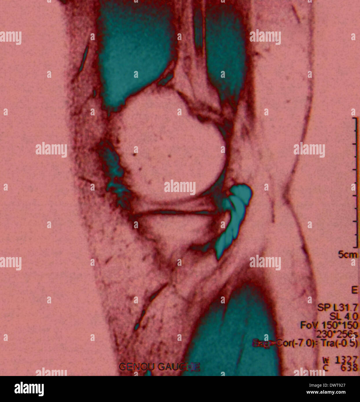 Lower limb mri hires stock photography and images Alamy