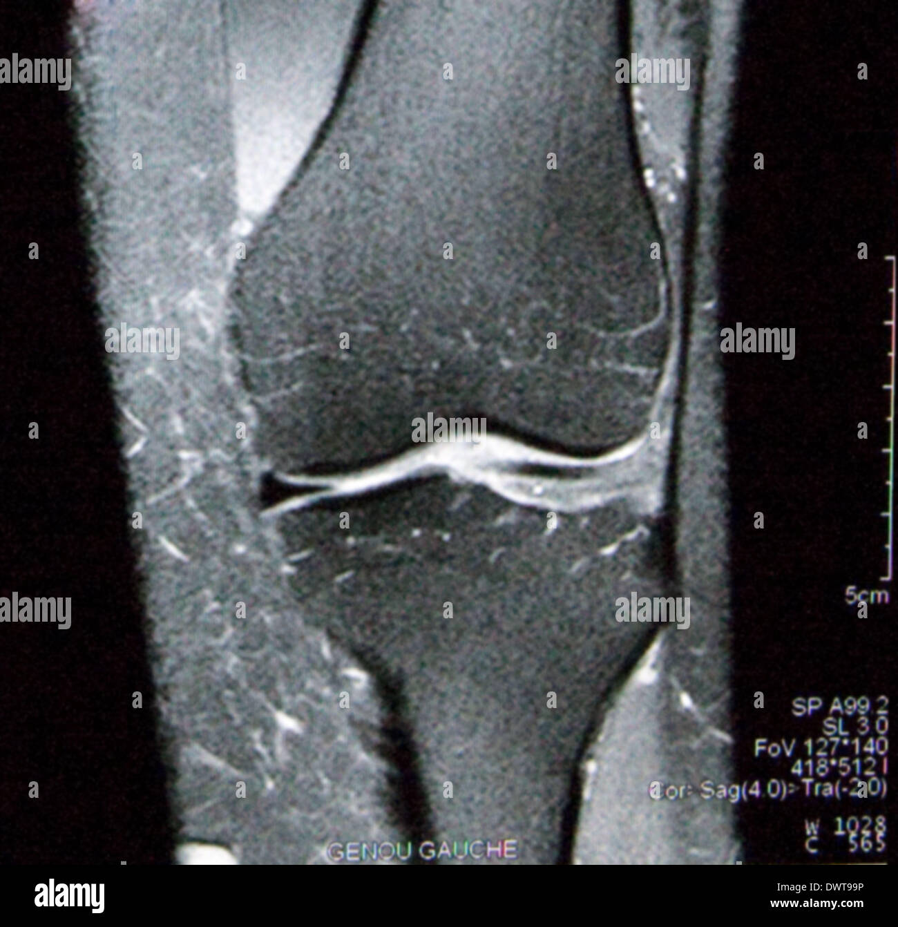 Knee mri hi-res stock photography and images - Alamy