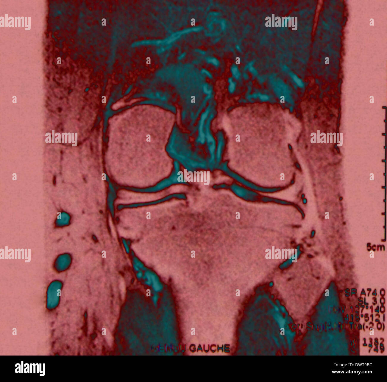 Knee mri Stock Photo