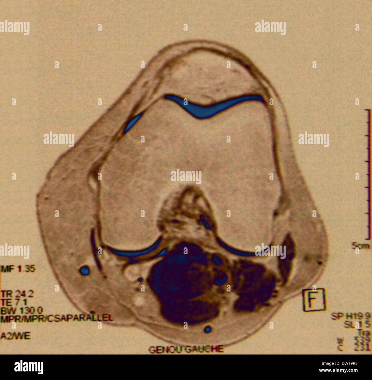 Knee mri Stock Photo