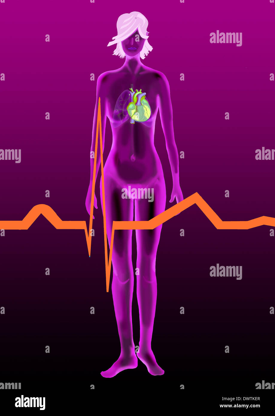 Cardiac rythm drawing Stock Photo - Alamy