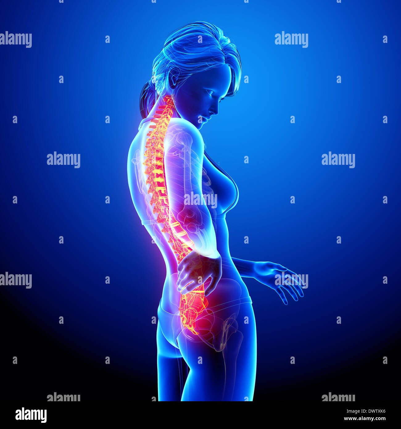 Back Problem Woman Diagram Back pain woman drawing Stock Photo - Alamy
