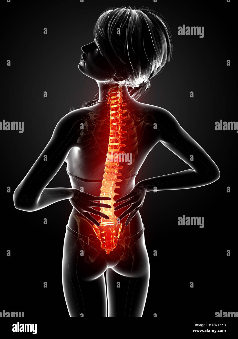 Back Problem Woman Diagram Back pain woman drawing Stock Photo - Alamy