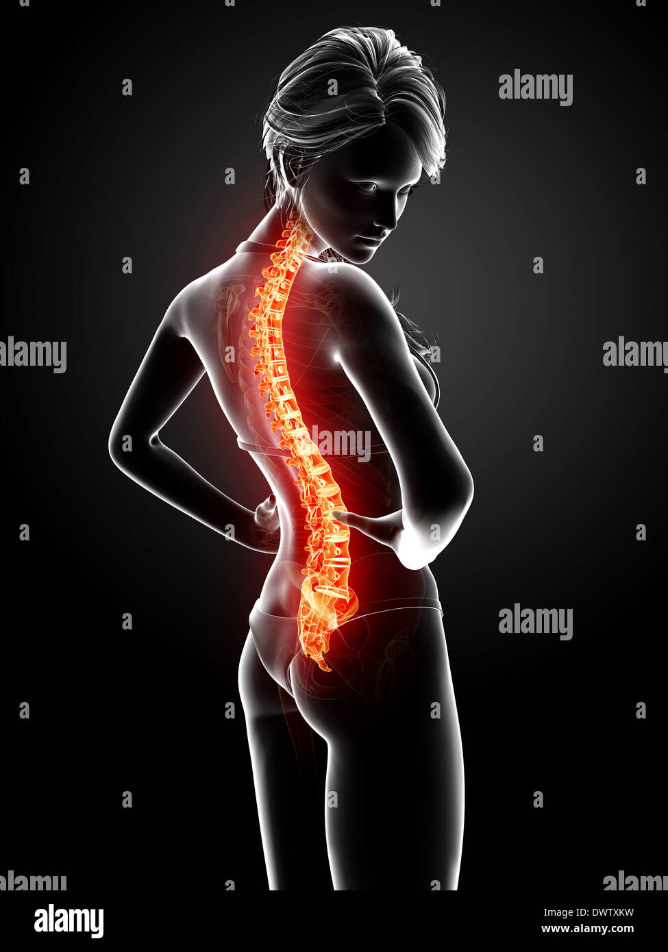 Back Problem Woman Diagram Back pain woman drawing Stock Photo - Alamy