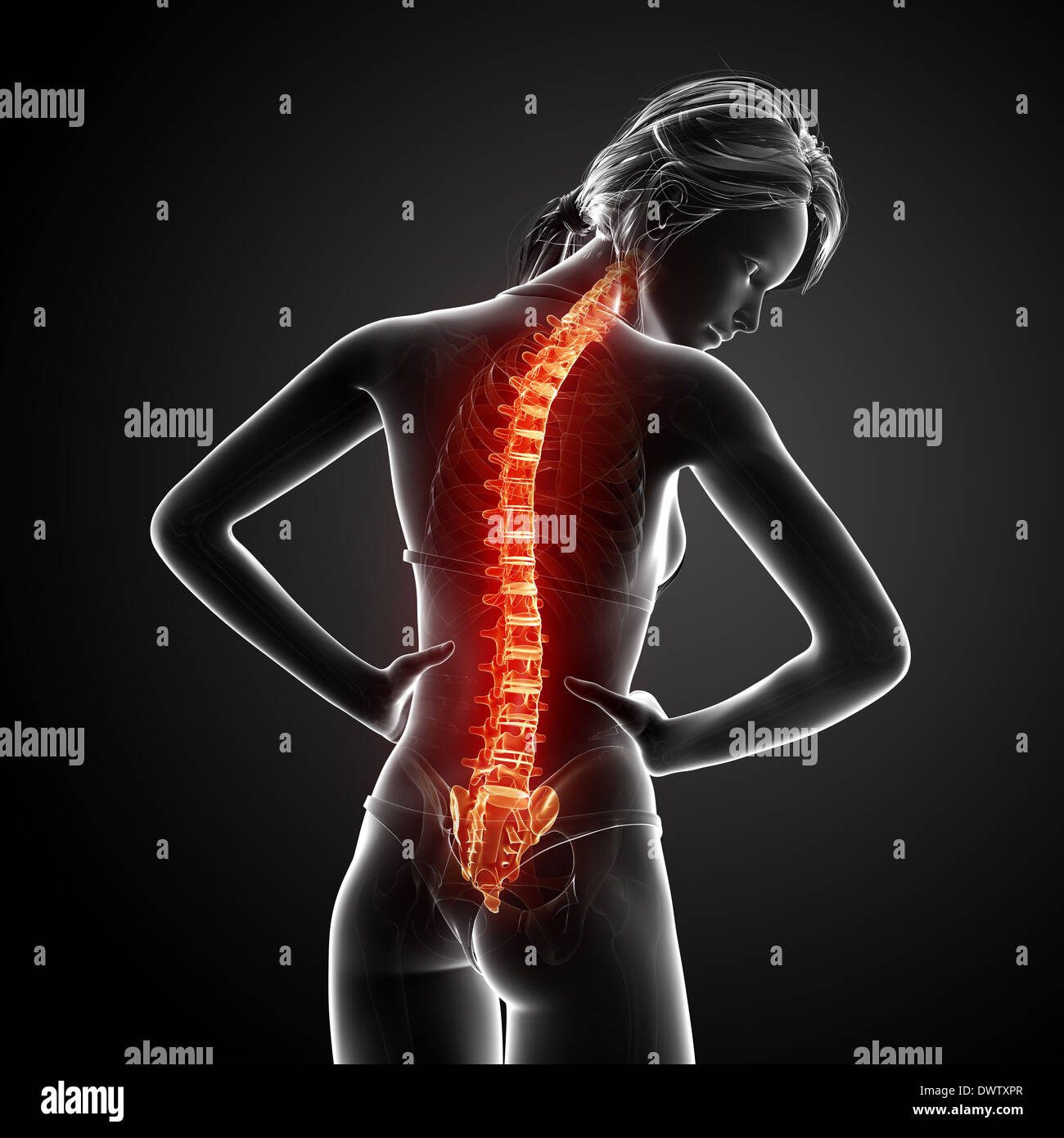 Back Problem Woman Diagram Back pain woman drawing Stock Photo - Alamy